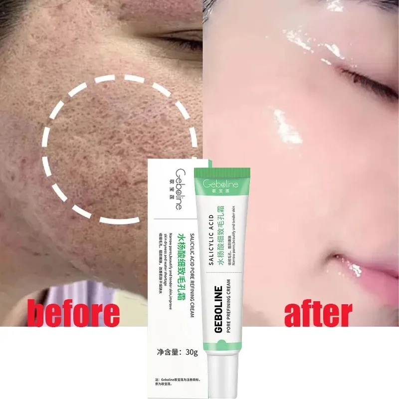 Luxury Skincare Products - Crema restringente per pori di acido