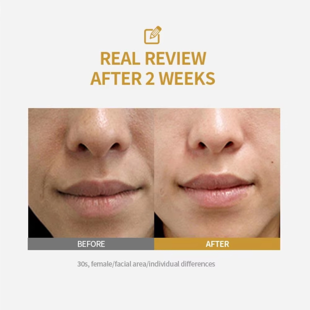 Fiala di sollevamento intensiv - Peptide Complex Serum recensione e prezzo